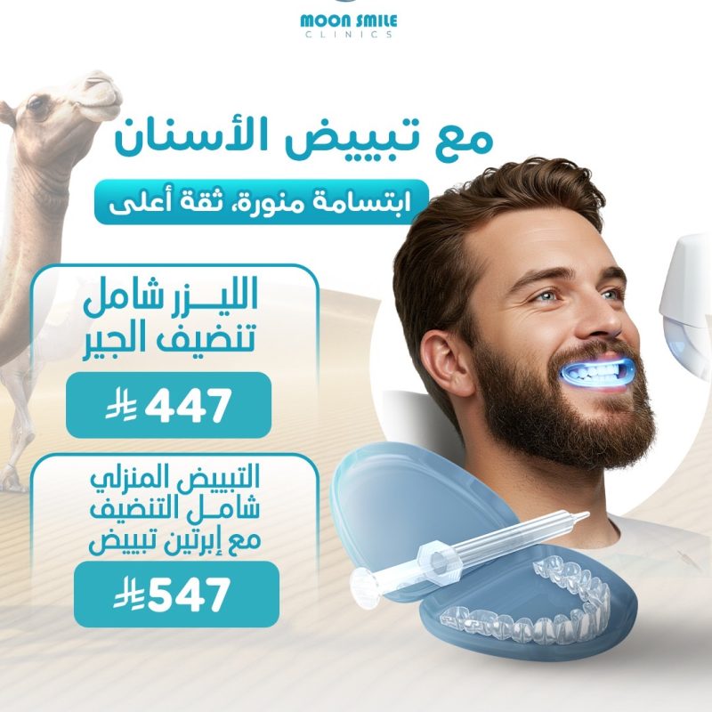 تبييض اسنان