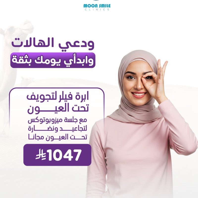 فيلر عيون
