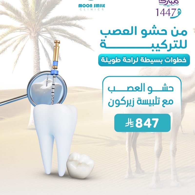 عصب وزيركون