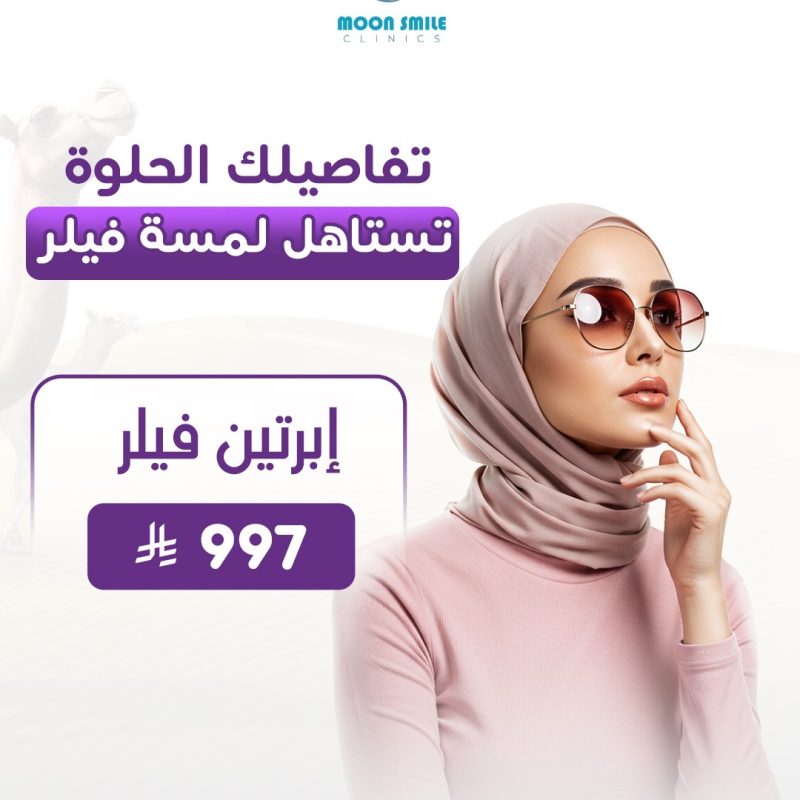 2 فيلر